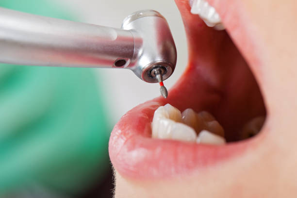 Best 24-Hour Emergency Dentist in Mccord, OK